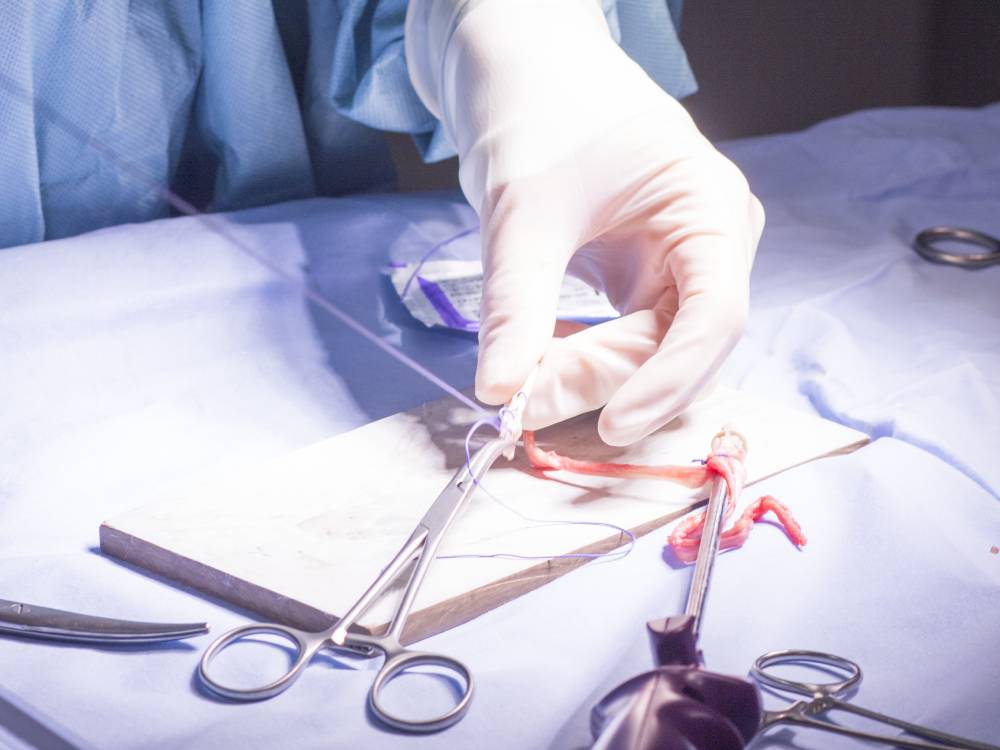 Cirugia testicular en puebla